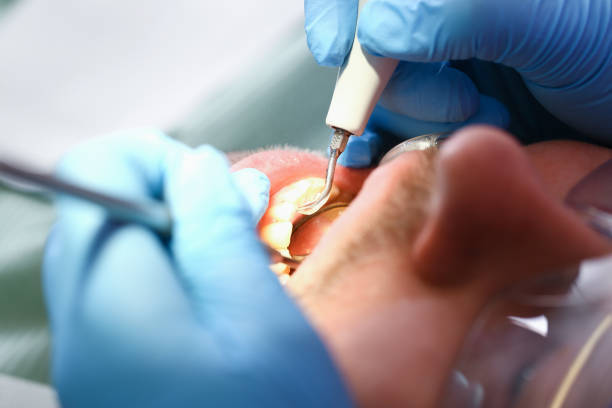 Best Emergency Broken Tooth Repair in Etna, PA
